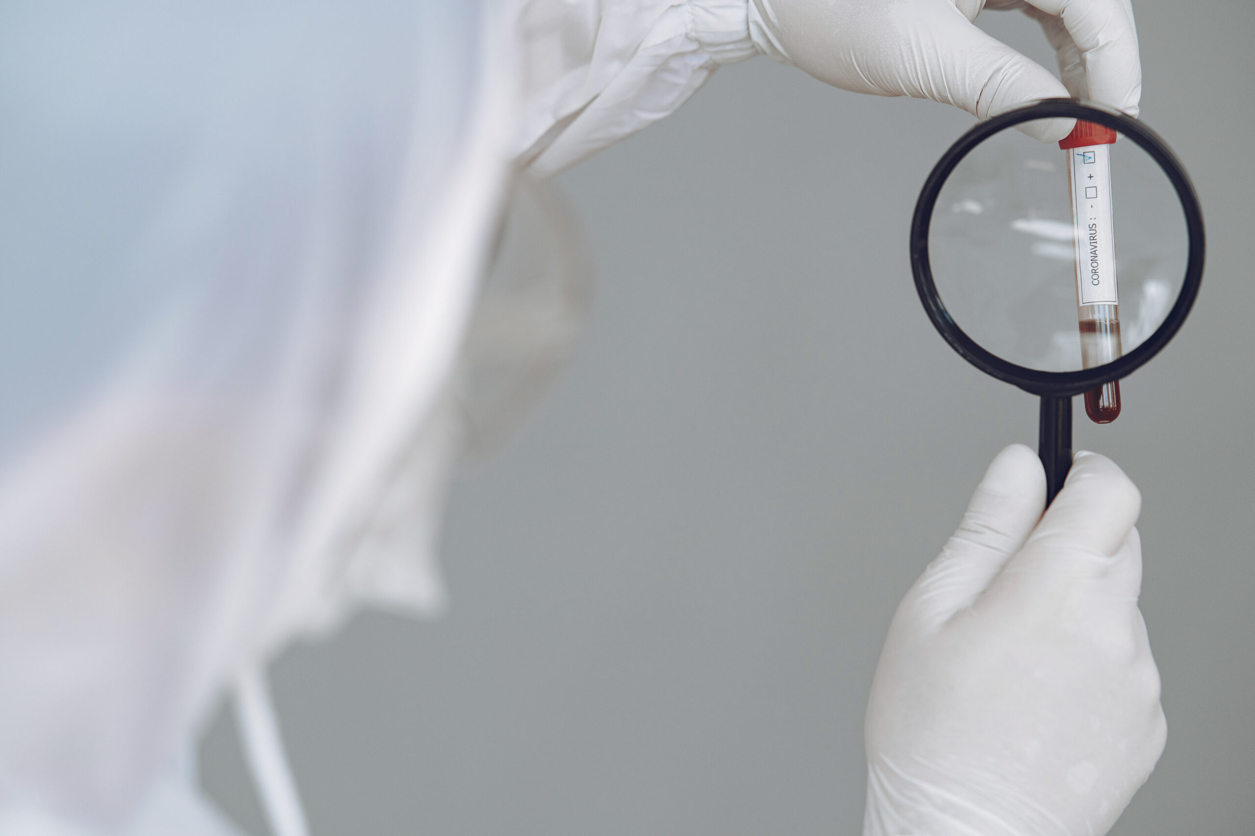 Hiv cure research